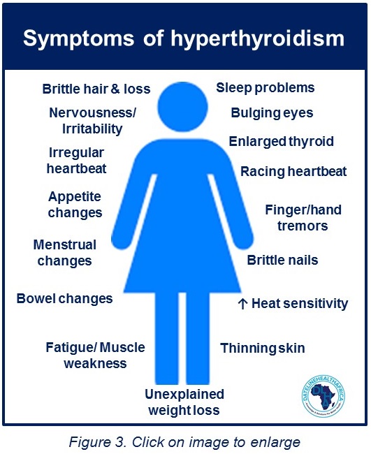 Hyperthyroidism In Nigeria Causes Symptoms Diagnosis And Treatment